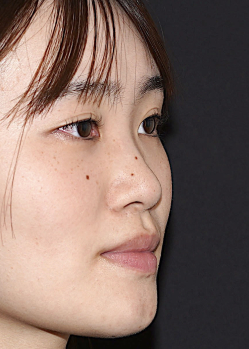 https://naresakyoto.com/wp-content/uploads/2025/05/ブログTOP鼻.001-1.jpeg